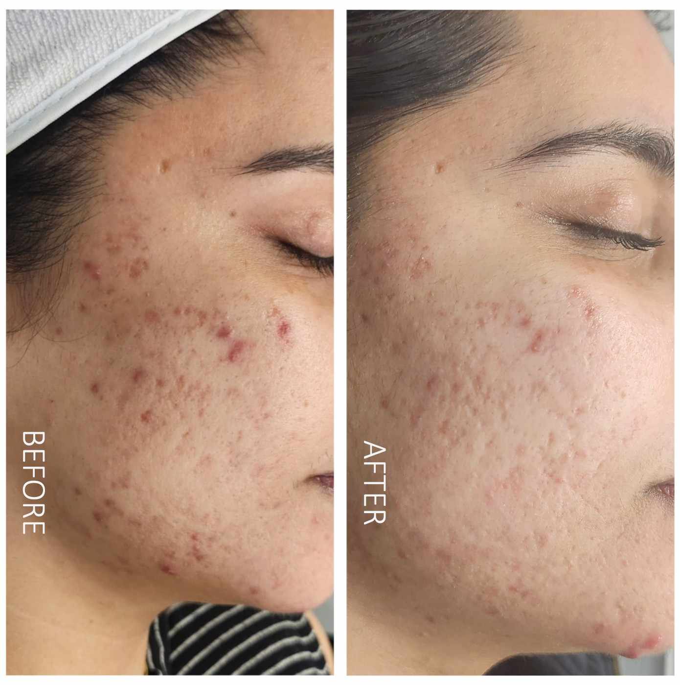 Before After