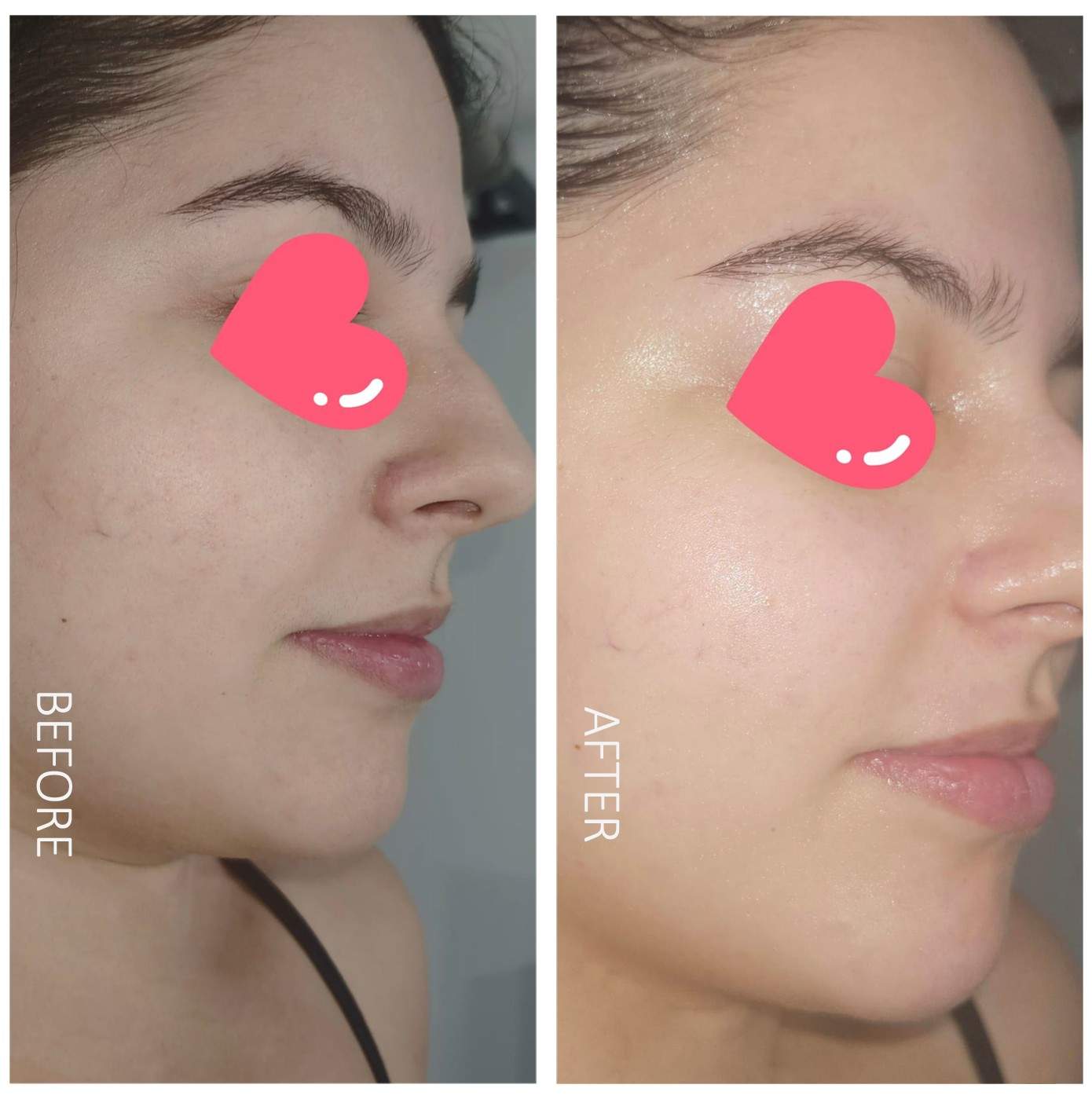 Before After
