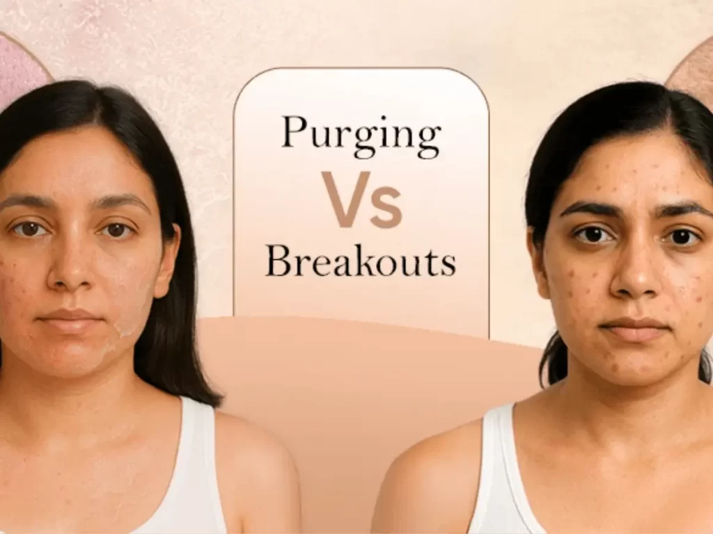 Illustration for the article: Skin Purging vs Breaking Out: How to Tell Which One You’re Having